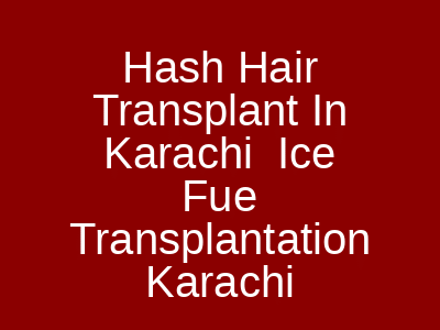 Hash Hair Transplant In Karachi Ice Fue Transplantation Karachi