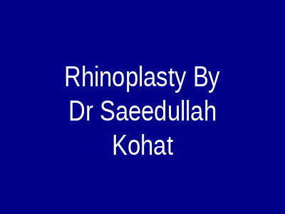 Rhinoplasty By Dr Saeedullah Kohat