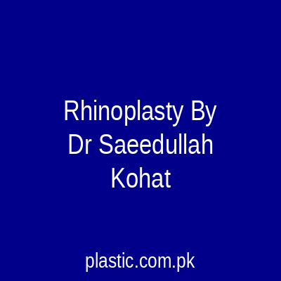 Rhinoplasty By Dr Saeedullah Kohat
